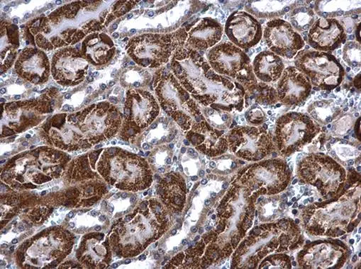 ACADM antibody detects ACADM protein at mitochondria in mouse kidney by immunohistochemical analysis. Sample: Paraffin-embedded mouse kidney. ACADM antibody (GTX100487) diluted at 1:500.
Antigen Retrieval: Citrate buffer, pH 6.0, 15 min ACADM antibody detects ACADM protein at mitochondria in mouse kidney by immunohistochemical analysis. Sample: Paraffin-embedded mouse kidney. ACADM antibody (GTX100487) diluted at 1:500.
Antigen Retrieval: Citrate buffer, pH 6.0, 15 min