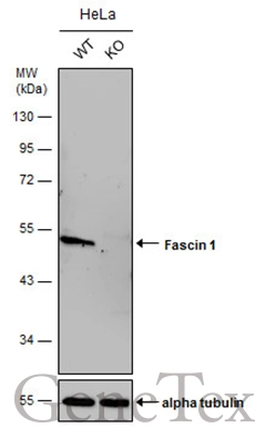 Wild-type (WT) and Fascin 1 knockout (KO) HeLa cell extracts (30 μg) were separated by 10% SDS-PAGE, and the membrane was blotted with Fascin 1 antibody [N2C2], Internal (GTX100511) diluted at 1:500. The HRP-conjugated anti-rabbit IgG antibody (GTX213110-01) was used to detect the primary antibody, and the signal was developed with Trident ECL plus-Enhanced.