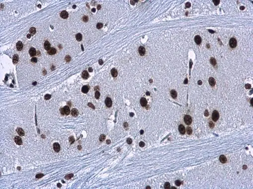 HMGA2 antibody detects HMGA2 protein at nucleus in rat brain by immunohistochemical analysis. Sample: Paraffin-embedded rat brain. HMGA2 antibody (GTX100519) diluted at 1:500. 
 Antigen Retrieval: Citrate buffer, pH 6.0, 15 min