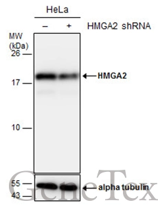 Anti-HMGA2 antibody - ChIP grade (GTX100519) | GeneTex Anti-HMGA2 antibody - ChIP grade (GTX100519) | GeneTex
