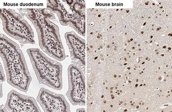 HMGA2 antibody - ChIP grade detects HMGA2 - ChIP grade protein by immunohistochemical analysis. Sample: Paraffin-embedded mouse tissues. HMGA2 - ChIP grade stained by HMGA2 antibody - ChIP grade (GTX100519) diluted at 1:500. Antigen Retrieval: Citrate buffer, pH 6.0, 15 min
