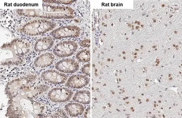 HMGA2 antibody - ChIP grade detects HMGA2 - ChIP grade protein by immunohistochemical analysis. Sample: Paraffin-embedded rat tissues. HMGA2 - ChIP grade stained by HMGA2 antibody - ChIP grade (GTX100519) diluted at 1:500. Antigen Retrieval: Citrate buffer, pH 6.0, 15 min