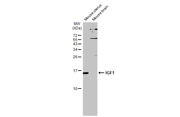 Various tissue extracts (50 μg) were separated by 15% SDS-PAGE, and the membrane was blotted with IGF1 antibody (GTX100521) diluted at 1:1000. The HRP-conjugated anti-rabbit IgG antibody (GTX213110-01) was used to detect the primary antibody.