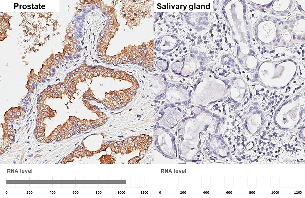 Kallikrein 2 antibody [N3C3] detects Kallikrein 2 protein by immunohistochemical analysis. Sample: Paraffin-embedded human tissues. Kallikrein 2 stained by Kallikrein 2 antibody [N3C3] (GTX100526) diluted at 1:1000. Antigen Retrieval: Citrate buffer, pH 6.0, 15 min