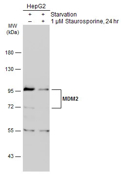 Untreated (–) and treated (+) HepG2 whole cell extracts (30 μg) were separated by 7.5% SDS-PAGE, and the membrane was blotted with MDM2 antibody (GTX100531) diluted at 1:3000. The HRP-conjugated anti-rabbit IgG antibody (GTX213110-01) was used to detect the primary antibody.