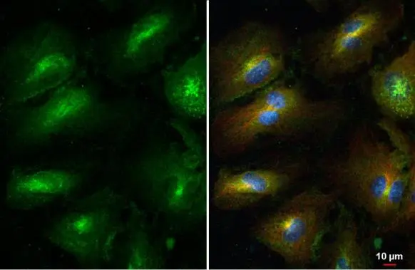 MMP1 antibody detects MMP1 protein at cytoplasm by immunofluorescent analysis. Sample: HUVEC cells were fixed in 4% paraformaldehyde at RT for 15 min. Green: MMP1 stained by MMP1 antibody (GTX100534) diluted at 1:500. Red: alpha Tubulin, a cytoskeleton marker, stained by alpha Tubulin antibody [GT114] (GTX628802) diluted at 1:1000. Blue: Fluoroshield with DAPI (GTX30920).