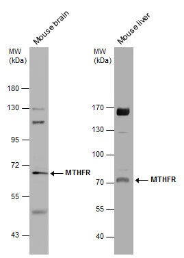 Various tissue extracts (50 μg) were separated by 7.5% SDS-PAGE, and the membrane was blotted with MTHFR antibody [N3C3] (GTX100535) diluted at 1:1000. The HRP-conjugated anti-rabbit IgG antibody (GTX213110-01) was used to detect the primary antibody.