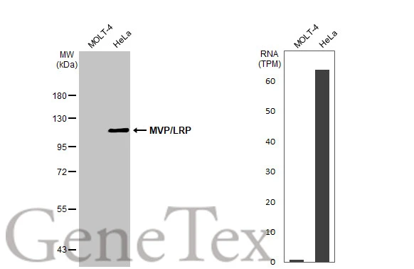 Various whole cell extracts (30 μg) were separated by 7.5% SDS-PAGE, and the membrane was blotted with MVP/LRP antibody [C2C3], C-term (GTX100536) diluted at 1:1000. The HRP-conjugated anti-rabbit IgG antibody (GTX213110-01) was used to detect the primary antibody. Corresponding RNA expression data for the same cell lines are based on Human Protein Atlas program.