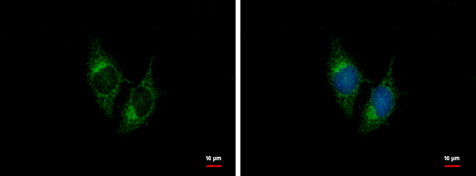 BNP antibody detects BNP protein by western blot analysis. Various whole cell extracts (30 ug) were separated by 15% SDS-PAGE,and the membrane was blotted with BNP antibody (GTX100538) diluted by 1:1000.