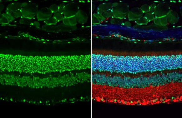 Rb antibody