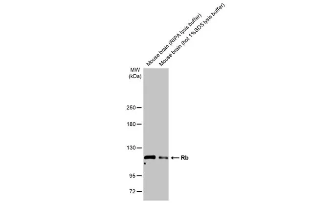 Mouse tissue extracts (50 μg) were separated by 5% SDS-PAGE, and the membrane was blotted with Rb antibody (GTX100545) diluted at 1:10000. The HRP-conjugated anti-rabbit IgG antibody (GTX213110-01) was used to detect the primary antibody, and the signal was developed with Trident ECL plus-Enhanced.
