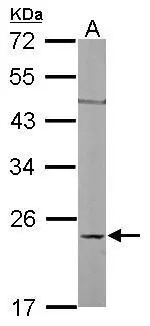 Sample (50 ug of whole cell lysate) A: mouse liver 12% SDS PAGE GTX100546 diluted at 1:1000