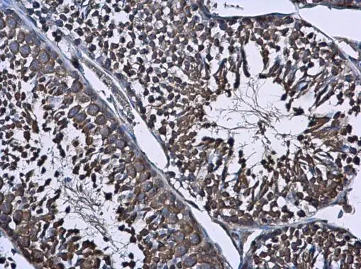 Wilms Tumor 1 antibody detects Wilms Tumor 1 protein at cytoplasm in mouse testis by immunohistochemical analysis. Sample: Paraffin-embedded mouse testis. Wilms Tumor 1 antibody (GTX100563) diluted at 1:500. 
 Antigen Retrieval: Citrate buffer, pH 6.0, 15 min