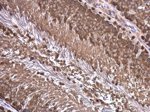 Wilms Tumor 1 antibody detects WT1 protein at cytoplasm in rat testis by immunohistochemical analysis. Sample: Paraffin-embedded rat testis. Wilms Tumor 1 antibody (GTX100563) diluted at 1:500. 
 Antigen Retrieval: Citrate buffer, pH 6.0, 15 min