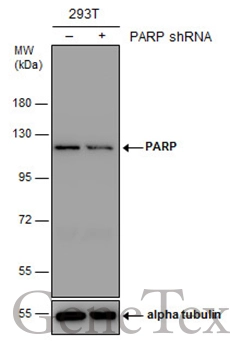 専用ページ*.゜ Anti-PARP antibody (GTX100573) | GeneTex