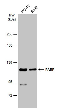 Various whole cell extracts (30 μg) were separated by 5% SDS-PAGE, and the membrane was blotted with PARP antibody (GTX100573) diluted at 1:1000. The HRP-conjugated anti-rabbit IgG antibody (GTX213110-01) was used to detect the primary antibody.