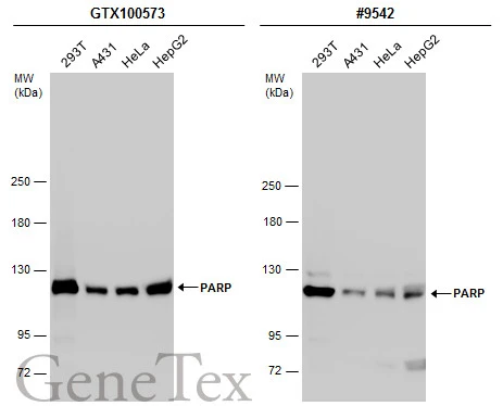 Various whole cell extracts (30 μg) were separated by 5% SDS-PAGE, and the membranes were blotted with PARP antibody (GTX100573) diluted at 1:2000 and competitor's antibody (#9542) diluted at 1:500. The HRP-conjugated anti-rabbit IgG antibody (GTX213110-01) was used to detect the primary antibody. *The competitor is not affiliated with GeneTex and does not endorse this product.