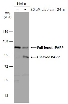 Untreated (–) and treated (+) HeLa whole cell extracts (30 μg) were separated by 7.5% SDS-PAGE, and the membrane was blotted with PARP antibody (GTX100573) diluted at 1:2000. The HRP-conjugated anti-rabbit IgG antibody (GTX213110-01) was used to detect the primary antibody.
