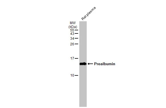 Rat plasma (50 μg) was separated by 15% SDS-PAGE, and the membrane was blotted with Prealbumin antibody [N1C3] (GTX100577) diluted at 1:500. The HRP-conjugated anti-rabbit IgG antibody (GTX213110-01) was used to detect the primary antibody.