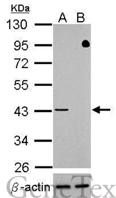 Western blot analysis of TDP-43 (GTX100579, upper panel) and beta-actin (GTX109639, lower panel)? Sample (30 ug of whole cell lysate) ? A: HeLa mock control? B: HeLa transfected shTDP-43 10% SDS PAGE? GTX100579 diluted at 1:500
