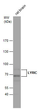 LYRIC antibody detects LYRIC protein by Western blot analysis. Rat tissue extracts (50 μg) was separated by 7.5 % SDS-PAGE, and the membrane was blotted with LYRIC antibody (GTX100587) diluted by 1:1000.