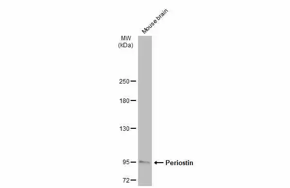Mouse tissue extract (50 μg) was separated by 5% SDS-PAGE, and the membrane was blotted with Periostin antibody (GTX100602) diluted at 1:500. The HRP-conjugated anti-rabbit IgG antibody (GTX213110-01) was used to detect the primary antibody, and the signal was developed with Trident ECL plus-Enhanced. Mouse tissue extract (50 μg) was separated by 5% SDS-PAGE, and the membrane was blotted with Periostin antibody (GTX100602) diluted at 1:500. The HRP-conjugated anti-rabbit IgG antibody (GTX213110-01) was used to detect the primary antibody, and the signal was developed with Trident ECL plus-Enhanced.