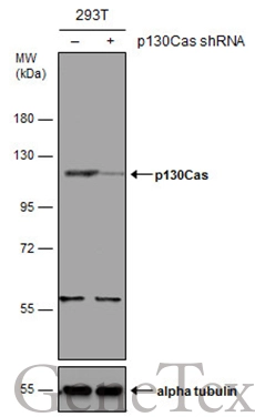 Non-transfected (–) and transfected (+) 293T whole cell extracts (30 μg) were separated by 7.5% SDS-PAGE, and the membrane was blotted with p130Cas antibody [N2C2], Internal (GTX100605) diluted at 1:500. The HRP-conjugated anti-rabbit IgG antibody (GTX213110-01) was used to detect the primary antibody.