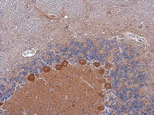 p130Cas antibody [N2C2], Internal detects p130Cas protein at cytoplasm in mouse brain by immunohistochemical analysis. Sample: Paraffin-embedded mouse brain. p130Cas antibody [N2C2], Internal (GTX100605) diluted at 1:500. 
 Antigen Retrieval: Citrate buffer, pH 6.0, 15 min