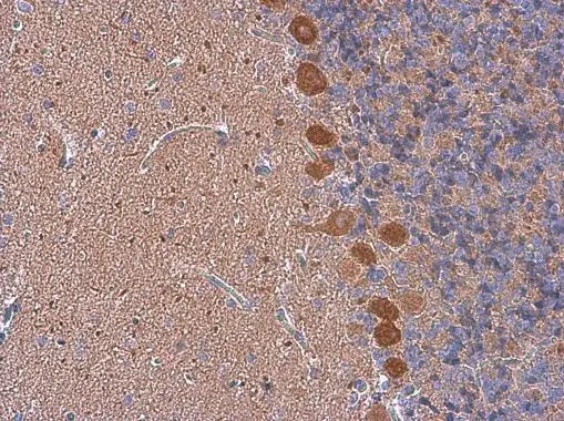 p130Cas antibody [N2C2], Internal detects p130Cas protein at cytoplasm in rat brain by immunohistochemical analysis. Sample: Paraffin-embedded rat brain. p130Cas antibody [N2C2], Internal (GTX100605) diluted at 1:500. 
 Antigen Retrieval: Citrate buffer, pH 6.0, 15 min