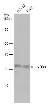 Various whole cell extracts (30 μg) were separated by 7.5% SDS-PAGE, and the membrane was blotted with c-Yes antibody (GTX100616) diluted at 1:500.