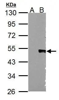 Wnt5a antibody
