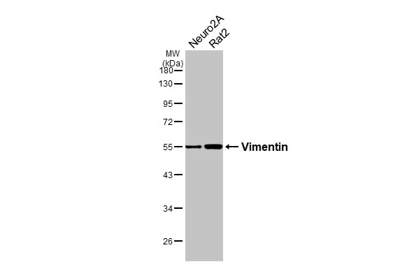 Anti-Vimentin antibody (GTX100619) | GeneTex