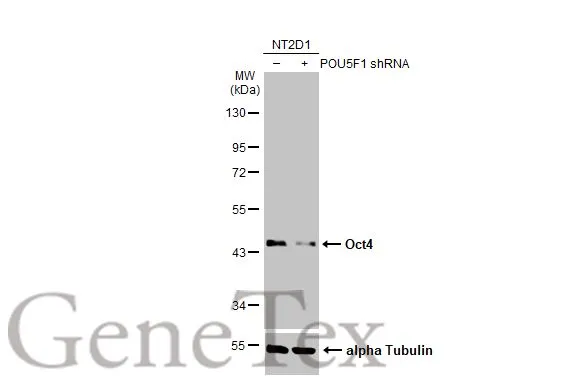 Non-transfected (–) and transfected (+) NT2D1 whole cell extracts (30 μg) were separated by 10% SDS-PAGE, and the membrane was blotted with Oct4 antibody (GTX100622) diluted at 1:10000. The HRP-conjugated anti-rabbit IgG antibody (GTX213110-01) was used to detect the primary antibody.