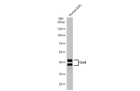 Human tissue extract (30 μg) was separated by 10% SDS-PAGE, and the membrane was blotted with Oct4 antibody (GTX100622) diluted at 1:5000. The HRP-conjugated anti-rabbit IgG antibody (GTX213110-01) was used to detect the primary antibody.