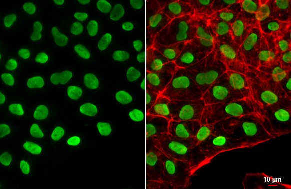 Oct4 antibody detects Oct4 protein at nucleus by immunofluorescent analysis. Sample: NT2D1 cells were fixed in 4% paraformaldehyde at RT for 15 min. Green: Oct4 stained by Oct4 antibody (GTX100622) diluted at 1:500. Red: phalloidin, a cytoskeleton marker, diluted at 1:200. Scale bar= 10 μm.