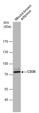 Mouse tissue extract (50 μg) was separated by 7.5% SDS-PAGE, and the membrane was blotted with CD36 antibody [C1C3] (GTX100642) diluted at 1:1000.