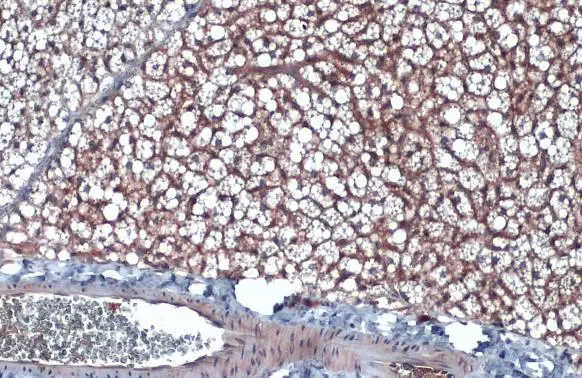 CD36 antibody [C1C3] detects CD36 protein by immunohistochemical analysis. Sample: Paraffin-embedded mouse brown adipocyte. CD36 stained by CD36 antibody [C1C3] (GTX100642) diluted at 1:500. Antigen Retrieval: Citrate buffer, pH 6.0, 15 min