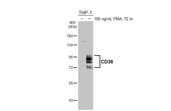 Anti-CD36 antibody [C1C3] (GTX100642) | GeneTex