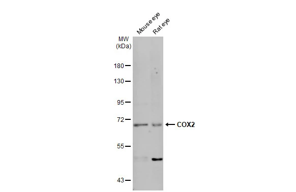 Various tissue extracts (50 μg) were separated by 7.5% SDS-PAGE, and the membrane was blotted with COX2 antibody [C3], C-term (GTX100656) diluted at 1:1000. The HRP-conjugated anti-rabbit IgG antibody (GTX213110-01) was used to detect the primary antibody, and the signal was developed with Trident femto Western HRP Substrate.