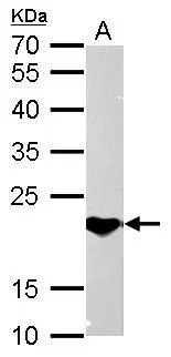 SOCS1 antibody detects SOCS1 protein by Western blot analysis. A. 50 μg mouse brain lysate/extract 12 % SDS-PAGE SOCS1 antibody (GTX100657) dilution: 1:2000