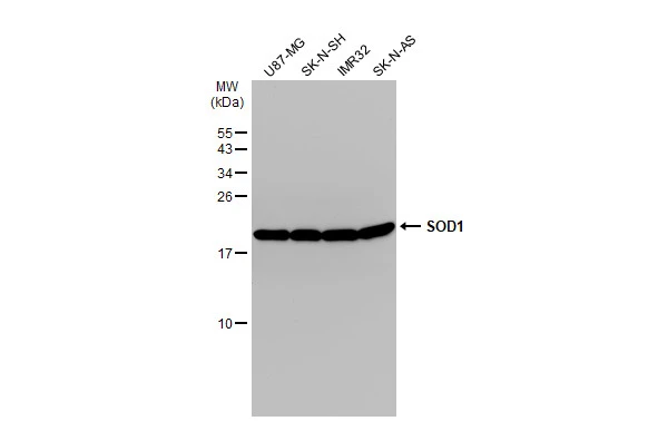 SOD1 antibody detects SOD1 protein by western blot analysis. Various whole cell extracts (30 ug) were separated by 15% SDS-PAGE,and the membrane was blotted with SOD1 antibody (GTX100659) diluted by 1:1000.