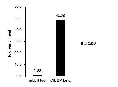 Immunohistochemical analysis of paraffin-embedded human ovarian cancer,using C/EBP beta(GTX100675) antibody at 1:250 dilution. Antigen Retrieval: Trilogy? (EDTA based,pH 8.0) buffer,15min