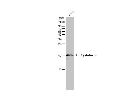 Whole cell extract (30 μg) was separated by 15% SDS-PAGE, and the membrane was blotted with Cystatin S antibody [N1N3] (GTX100690) diluted at 1:1000. The HRP-conjugated anti-rabbit IgG antibody (GTX213110-01) was used to detect the primary antibody.