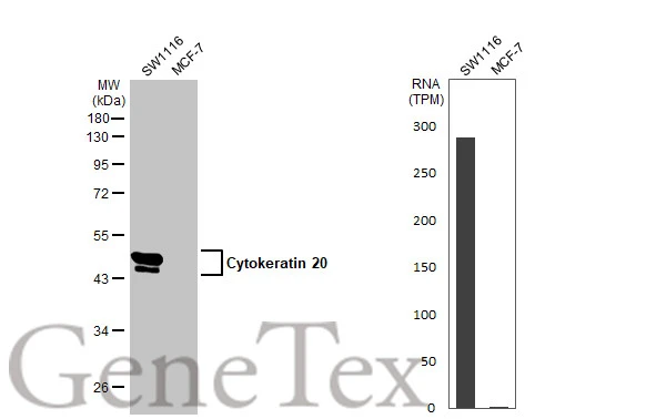 Various whole cell extracts (30 μg) were separated by 10% SDS-PAGE, and the membrane was blotted with Cytokeratin 20 antibody [C2C3], C-term (GTX100693) diluted at 1:1000. The HRP-conjugated anti-rabbit IgG antibody (GTX213110-01) was used to detect the primary antibody. Corresponding RNA expression data for the same cell lines are based on Human Protein Atlas program.