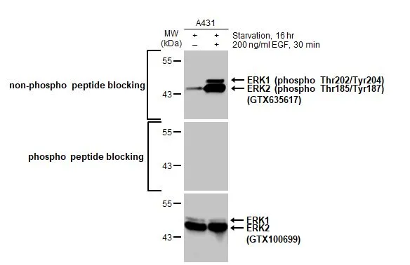 Untreated (–) and treated (+) A431 whole cell extracts (30 μg) were separated by 10% SDS-PAGE, and the membrane was blotted with ERK1 antibody (GTX100699) diluted at 1:1000. The HRP-conjugated anti-rabbit IgG antibody (GTX213110-01) was used to detect the primary antibody, and the signal was developed with Trident ECL plus-Enhanced.
