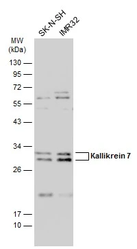 Various whole cell extracts (30 μg) were separated by 12% SDS-PAGE, and the membrane was blotted with Kallikrein 7 antibody (GTX100700) diluted at 1:1000. The HRP-conjugated anti-rabbit IgG antibody (GTX213110-01) was used to detect the primary antibody.