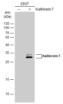 Non-transfected (–) and transfected (+) 293T whole cell extracts (30 μg) were separated by 12% SDS-PAGE, and the membrane was blotted with Kallikrein 7 antibody (GTX100700) diluted at 1:1000. The HRP-conjugated anti-rabbit IgG antibody (GTX213110-01) was used to detect the primary antibody.