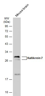 Mouse tissue extract (50 μg) was separated by 12% SDS-PAGE, and the membrane was blotted with Kallikrein 7 antibody (GTX100700) diluted at 1:3000. The HRP-conjugated anti-rabbit IgG antibody (GTX213110-01) was used to detect the primary antibody.