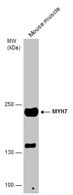 Mouse tissue extract (50 μg) was separated by 5% SDS-PAGE, and the membrane was blotted with MYH7 antibody [N1], N-term (GTX100713) diluted at 1:2000.
