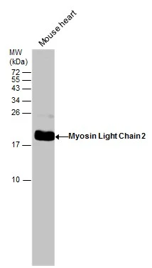Mouse tissue extract (50 μg) was separated by 15% SDS-PAGE, and the membrane was blotted with Myosin Light Chain 2 antibody (GTX100714) diluted at 1:20000.